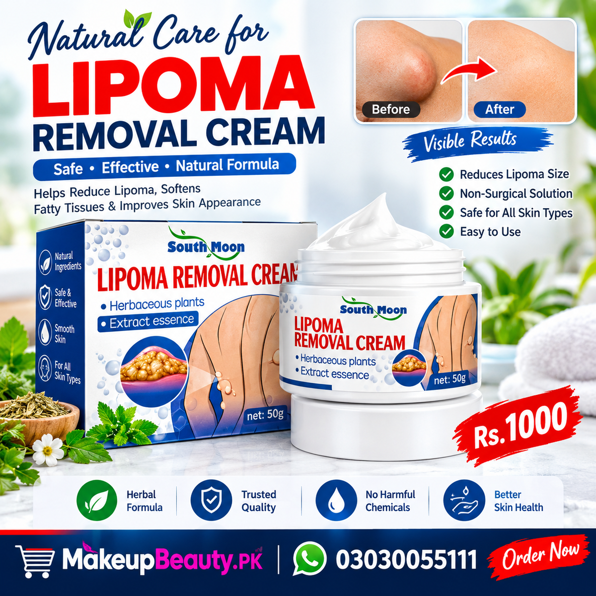 Lipoma Removal Cream