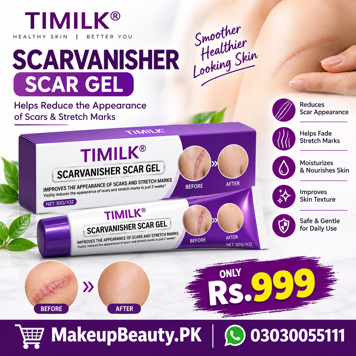 TIMILK ScarVanisher Scar Gel